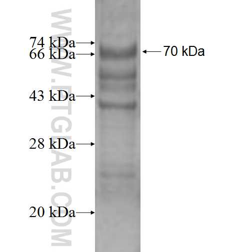 SERPINA4 fusion protein Ag1962 SDS-PAGE