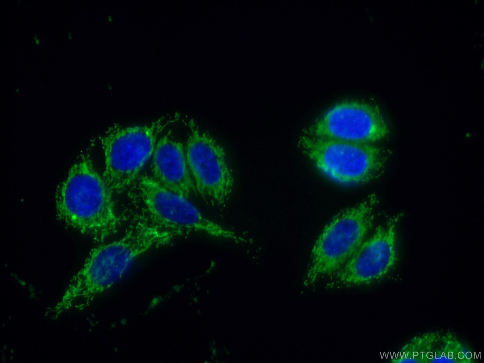 Immunofluorescence (IF) / fluorescent staining of HepG2 cells using Protein C inhibitor Polyclonal antibody (10673-1-AP)
