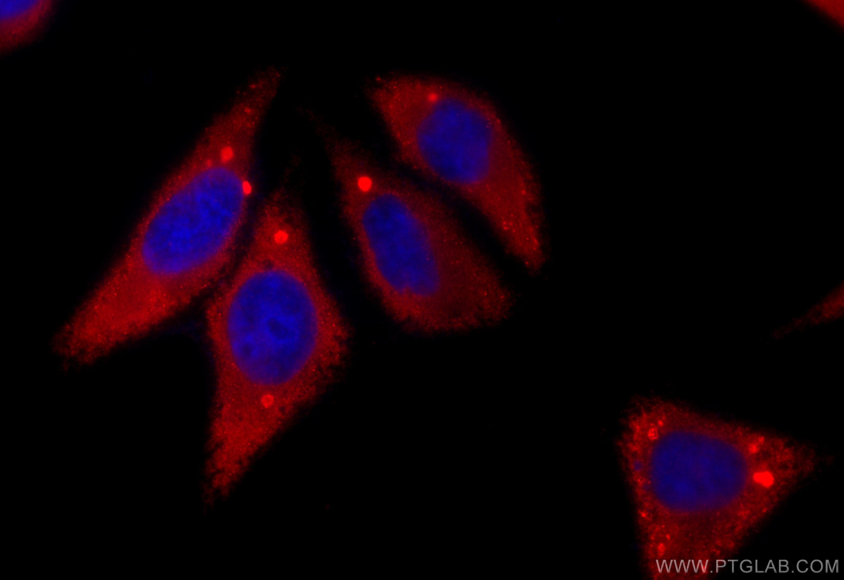 Immunofluorescence (IF) / fluorescent staining of HepG2 cells using Protein C inhibitor Polyclonal antibody (10673-1-AP)