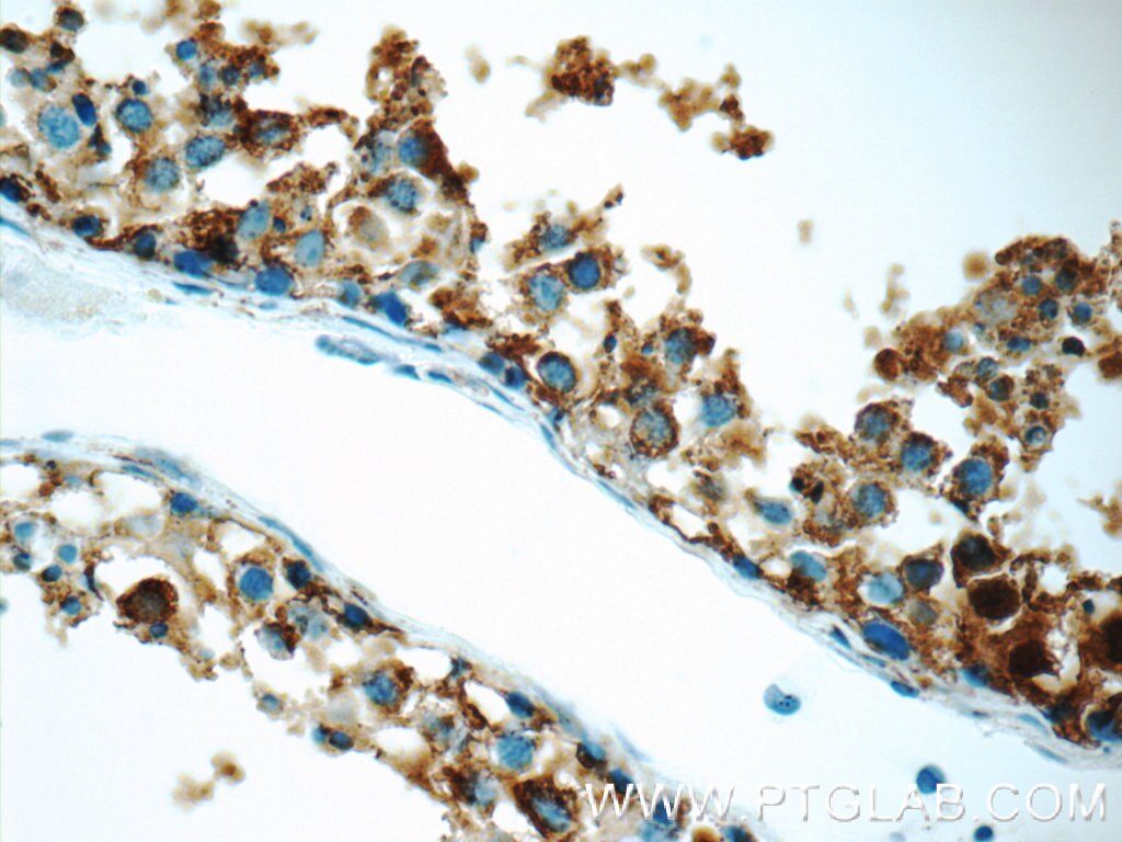 Immunohistochemistry (IHC) staining of human testis tissue using Protein C inhibitor Polyclonal antibody (10673-1-AP)