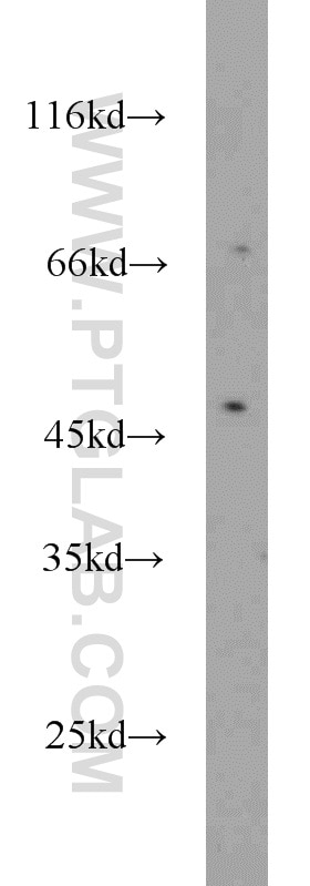 Protein C inhibitor