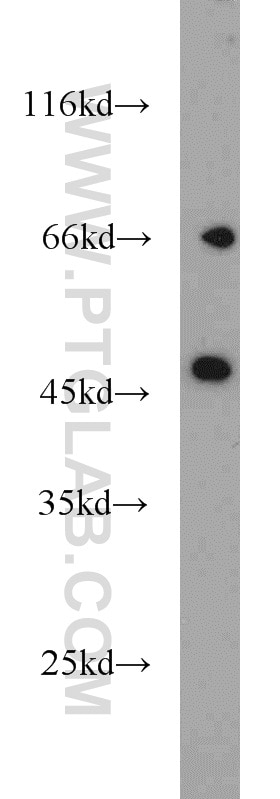 Western Blot (WB) analysis of Jurkat cells using Protein C inhibitor Polyclonal antibody (10673-1-AP)
