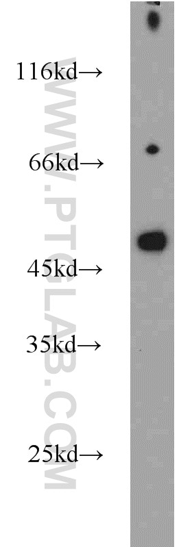 Western Blot (WB) analysis of A549 cells using Protein C inhibitor Polyclonal antibody (10673-1-AP)