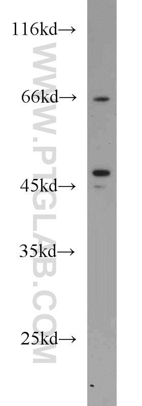 Western Blot (WB) analysis of HeLa cells using Protein C inhibitor Polyclonal antibody (10673-1-AP)