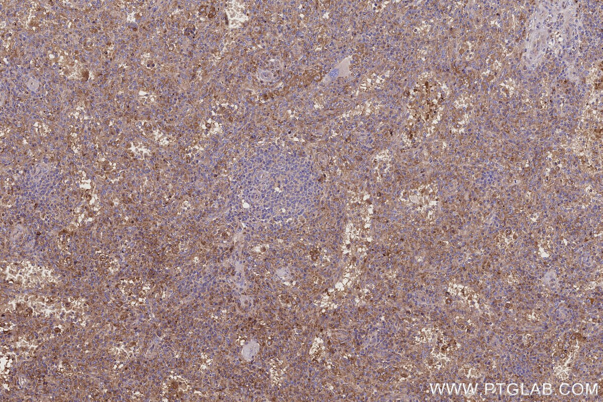 IHC staining of human spleen using 66030-1-Ig Immunohistochemistry (IHC) staining of human spleen tissue using Serpin A5/Protein C Inhibitor Monoclonal antibody (66030-1-Ig)