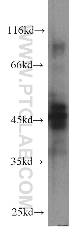 Western Blot (WB) analysis of human testis tissue using Protein C inhibitor Monoclonal antibody (66030-1-Ig)