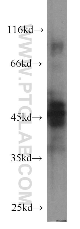 WB analysis of human testis using 66030-1-Ig