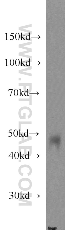 Western Blot (WB) analysis of human spleen tissue using Protein C inhibitor Monoclonal antibody (66030-1-Ig)
