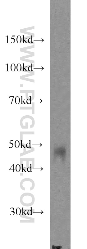 WB analysis of human spleen using 66030-1-Ig