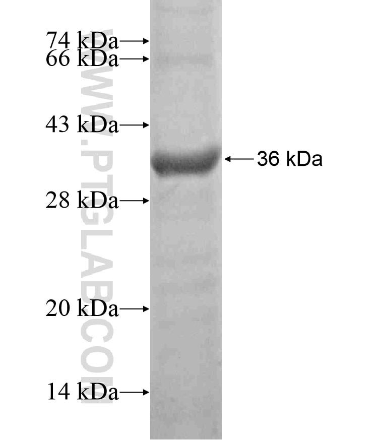 SERPINA5 fusion protein Ag18094 SDS-PAGE