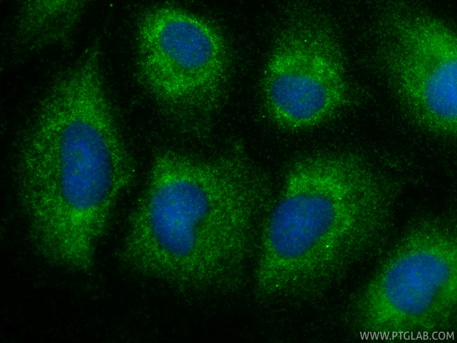 IF Staining of A549 using 12010-1-AP (same clone as 12010-1-PBS) Immunofluorescence (IF) / fluorescent staining of A549 cells using SERPINA6/CBG Polyclonal antibody (12010-1-AP)