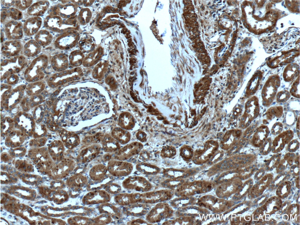 IHC staining of human kidney using 12010-1-AP