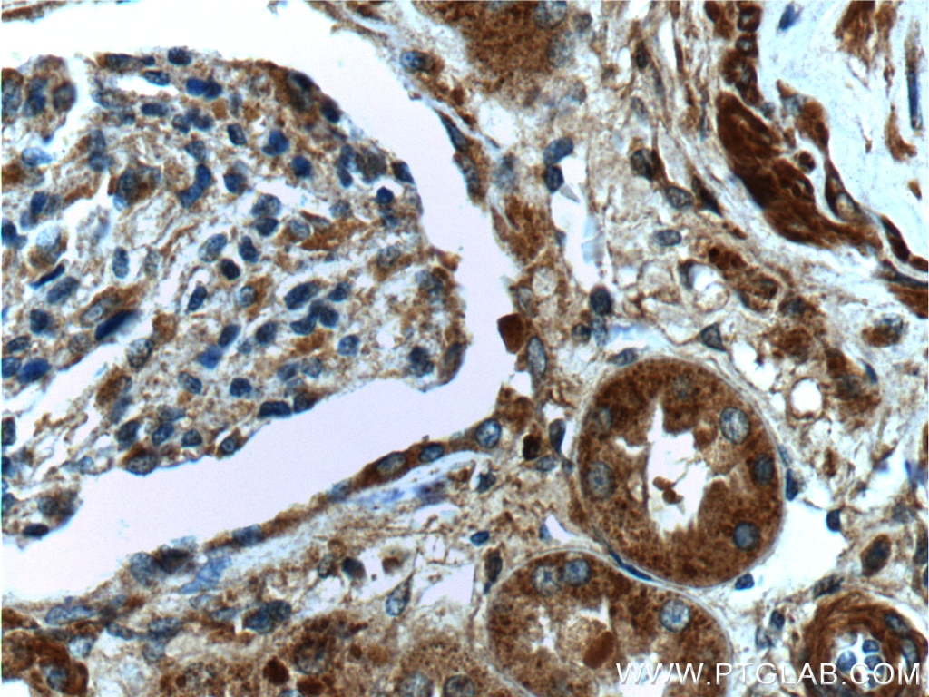 Immunohistochemistry (IHC) staining of human kidney tissue using SERPINA6/CBG Polyclonal antibody (12010-1-AP)