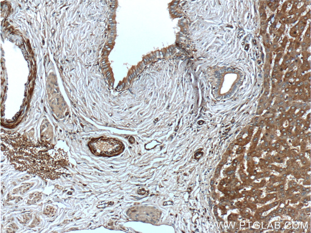 IHC staining of human liver using 12010-1-AP