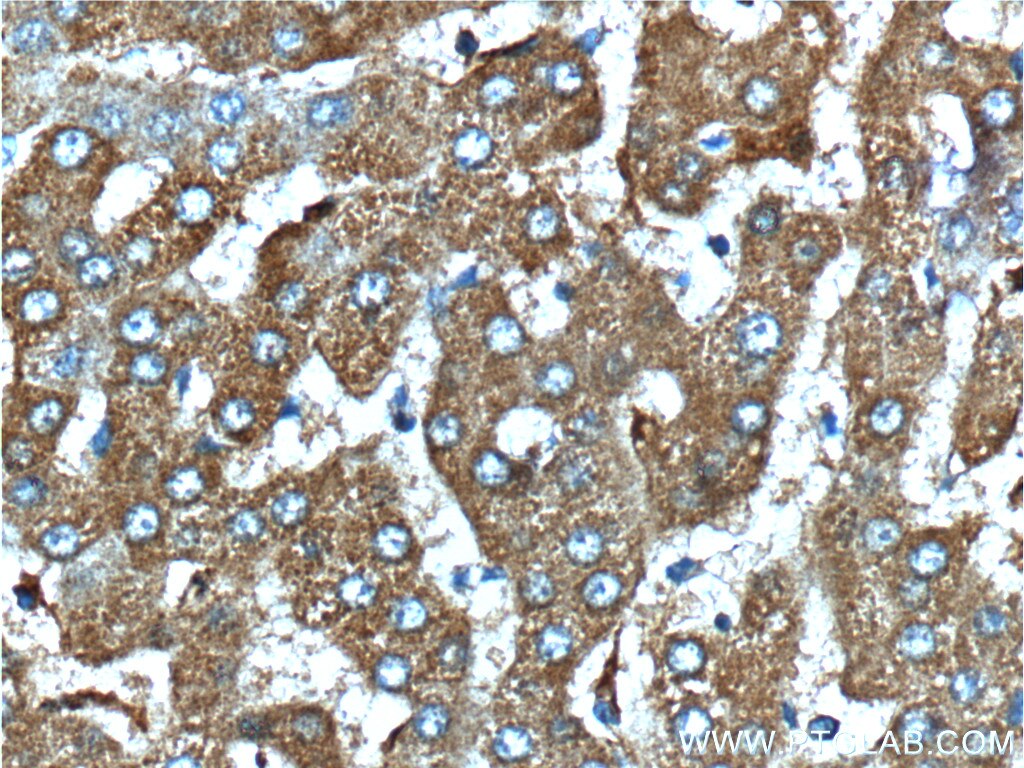 Immunohistochemistry (IHC) staining of human liver tissue using SERPINA6/CBG Polyclonal antibody (12010-1-AP)