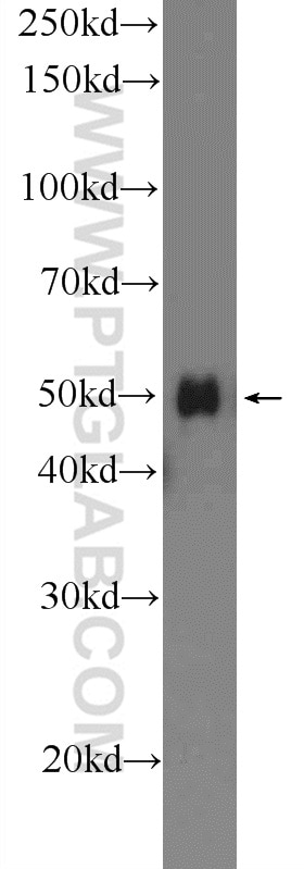 Western Blot (WB) analysis of HEK-293 cells using SERPINA6/CBG Polyclonal antibody (12010-1-AP)