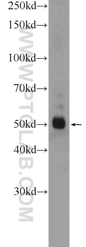 WB analysis of L02 using 12010-1-AP