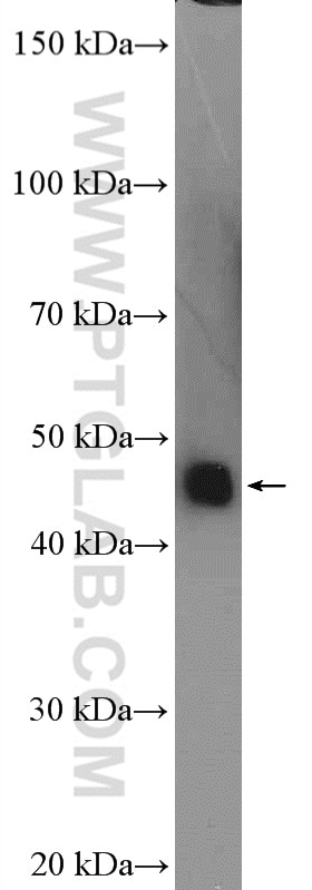 Western Blot (WB) analysis of human plasma using SERPINA6/CBG Polyclonal antibody (12010-1-AP)