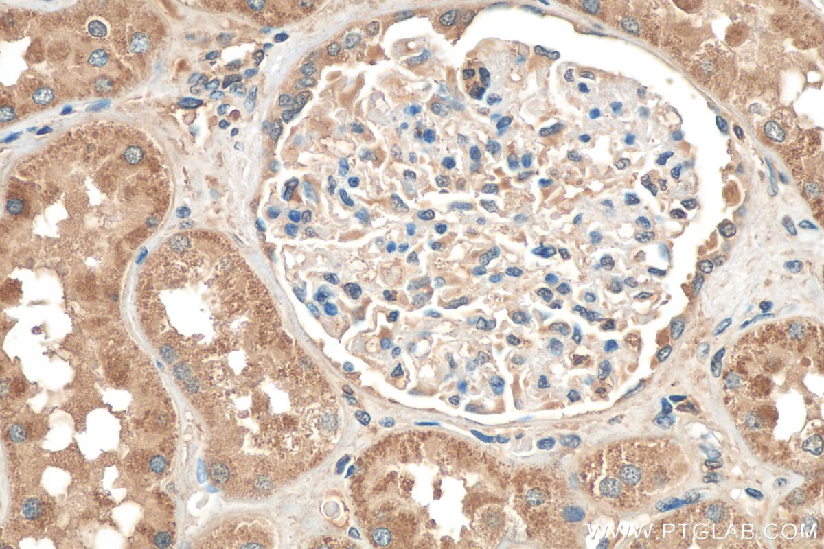 Immunohistochemistry (IHC) staining of human kidney tissue using SERPINA6/CBG Polyclonal antibody (29931-1-AP)