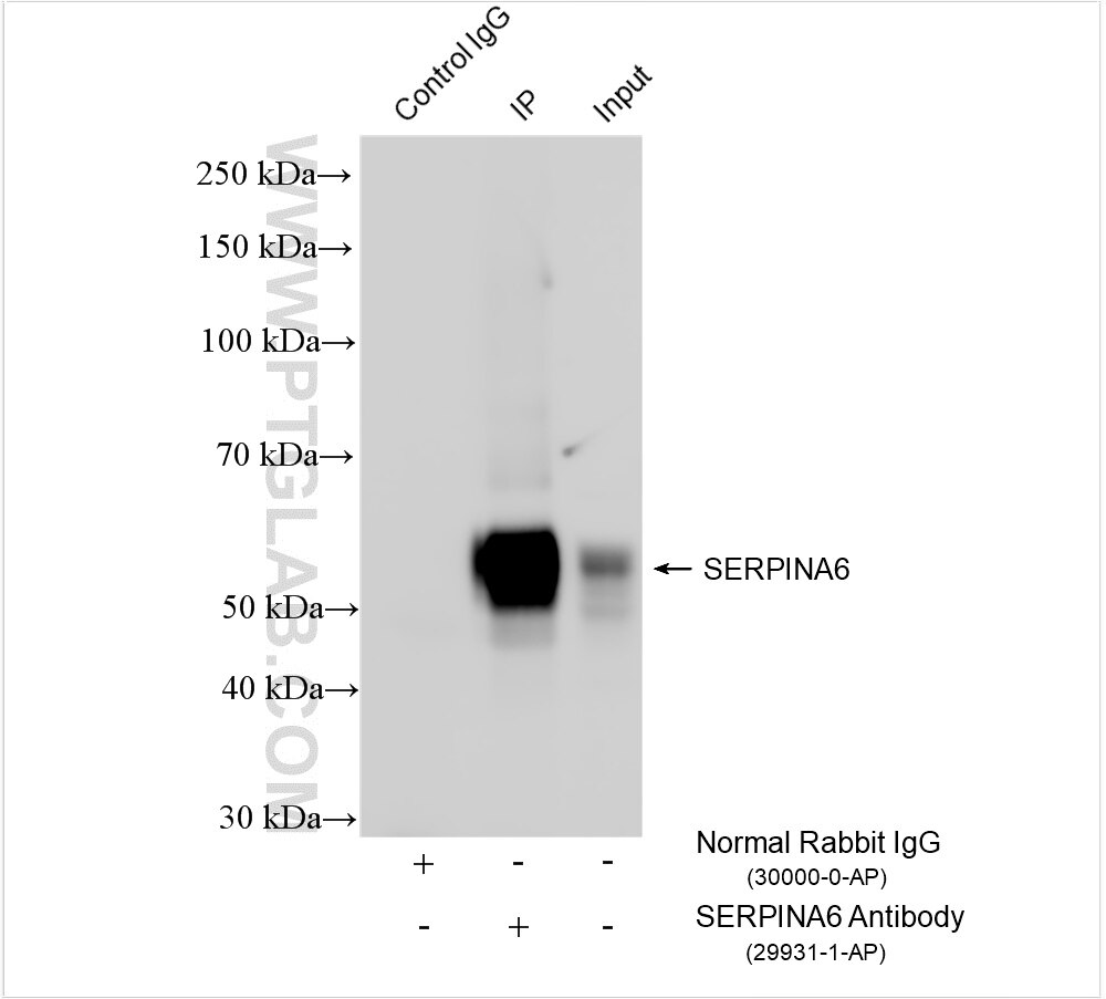 Immunoprecipitation (IP) experiment of human placenta tissue using SERPINA6/CBG Polyclonal antibody (29931-1-AP)
