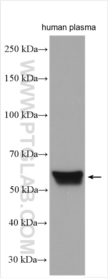 Western Blot (WB) analysis of human plasma using SERPINA6/CBG Polyclonal antibody (29931-1-AP)