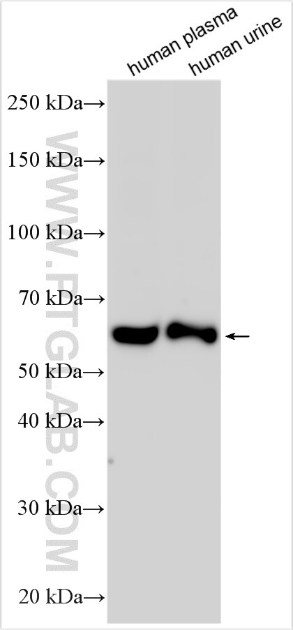 Western Blot (WB) analysis of various lysates using SERPINA7/TBG Polyclonal antibody (16536-1-AP)