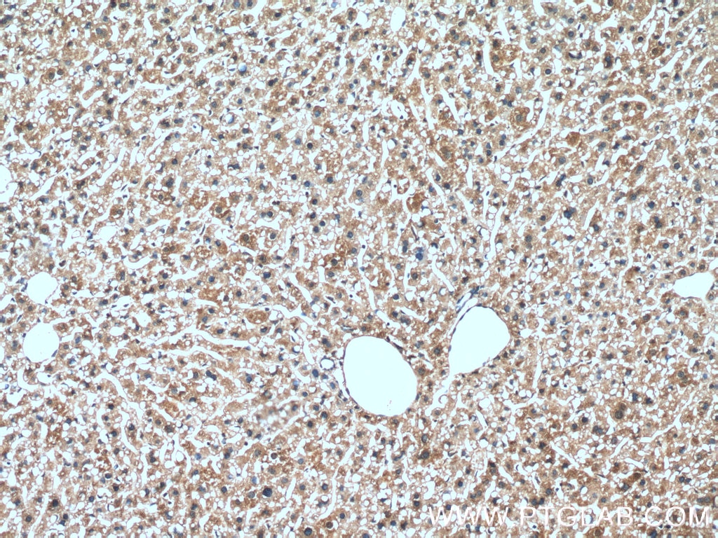 Immunohistochemistry (IHC) staining of mouse liver tissue using SERPINA7 Monoclonal antibody (66454-1-Ig)