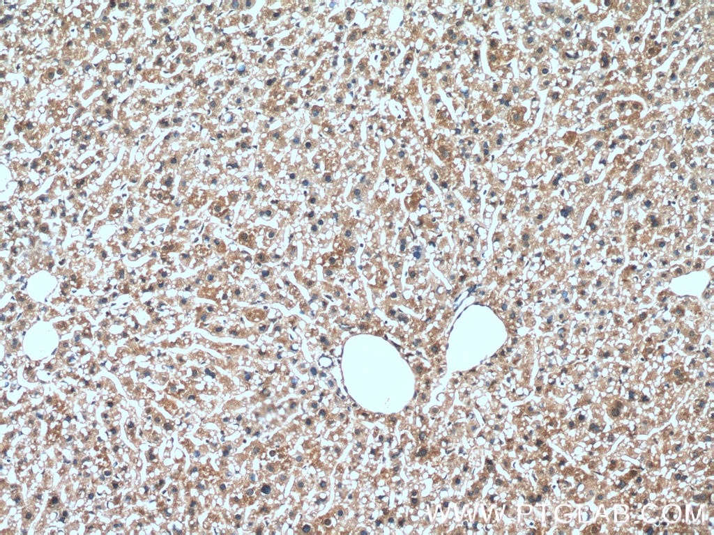 IHC staining of mouse liver using 66454-1-Ig