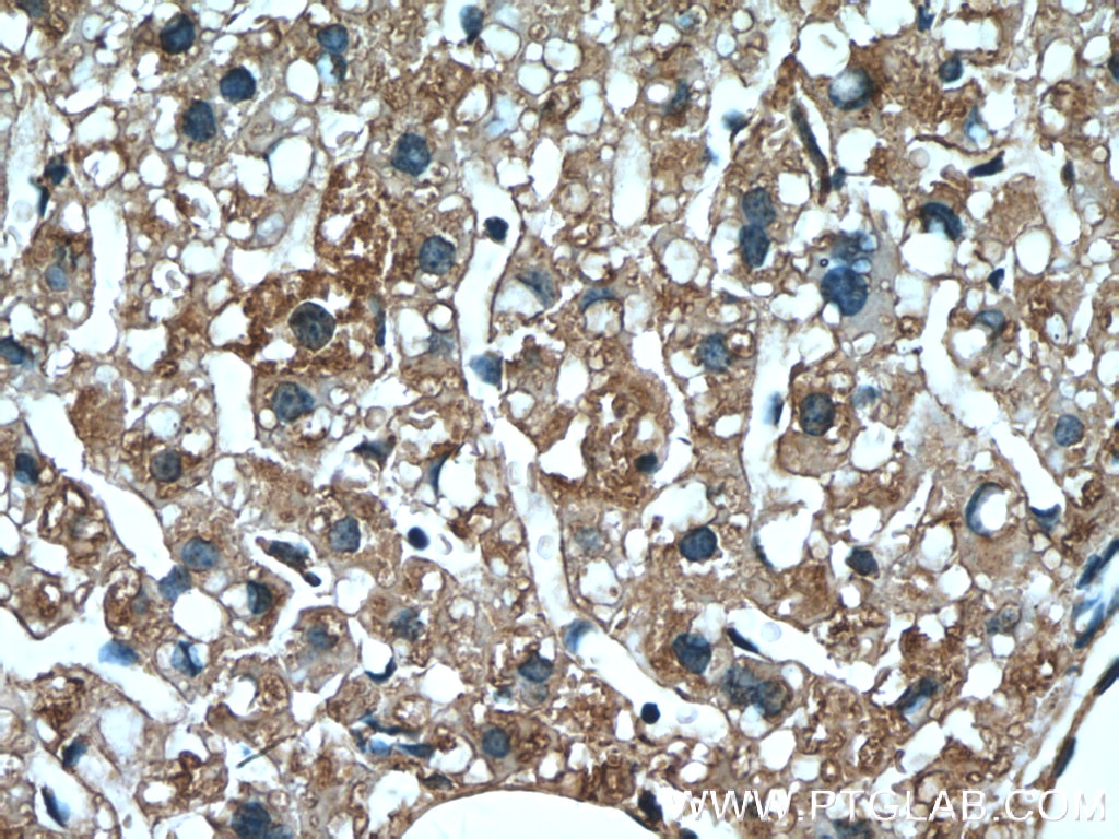 Immunohistochemistry (IHC) staining of mouse liver tissue using SERPINA7 Monoclonal antibody (66454-1-Ig)