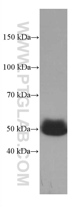 Western Blot (WB) analysis of human plasma using SERPINA7 Monoclonal antibody (66454-1-Ig)