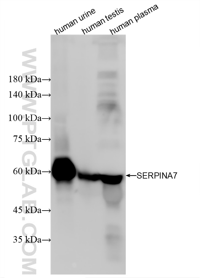Various lysates were subjected to SDS PAGE followed by western blot with 86893-4-RR (SERPINA7 antibody) at dilution of 1:3000 incubated at room temperature for 1.5 hours. Western Blot (WB) analysis of various lysates using SERPINA7 Recombinant monoclonal antibody (86893-4-RR)