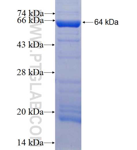 SERPINA7 fusion protein Ag9781 SDS-PAGE