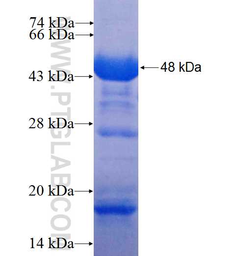 SERPINA7 fusion protein Ag9823 SDS-PAGE