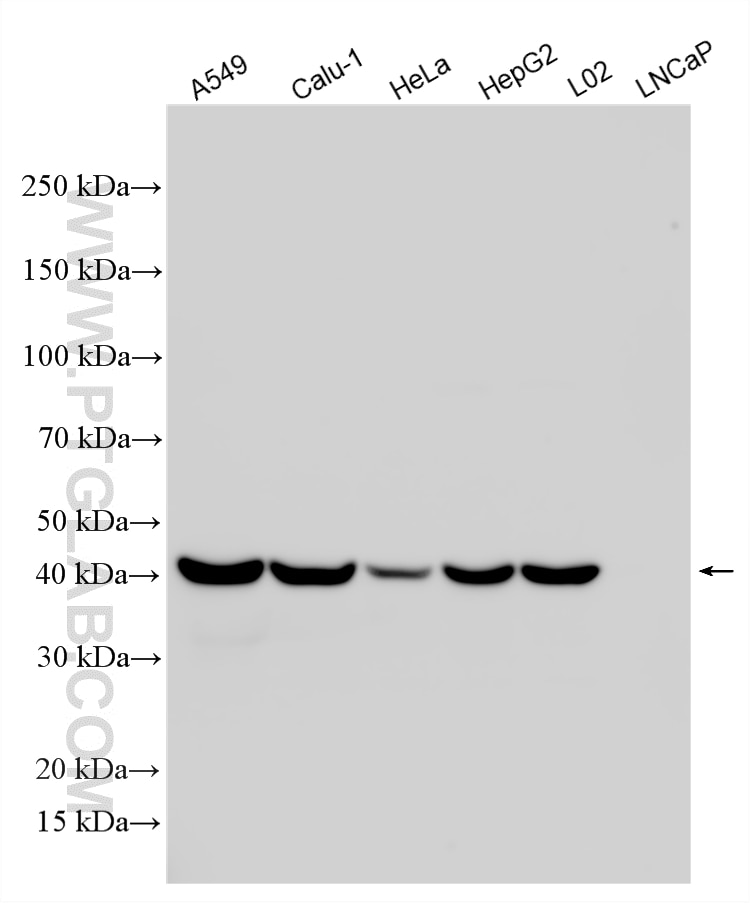 Various lysates were subjected to SDS PAGE followed by western blot with 33756-1-AP (SERPINB1 antibody) at dilution of 1:2000 incubated at room temperature for 1.5 hours. Western Blot (WB) analysis of various lysates using SERPINB1 Polyclonal antibody (33756-1-AP)
