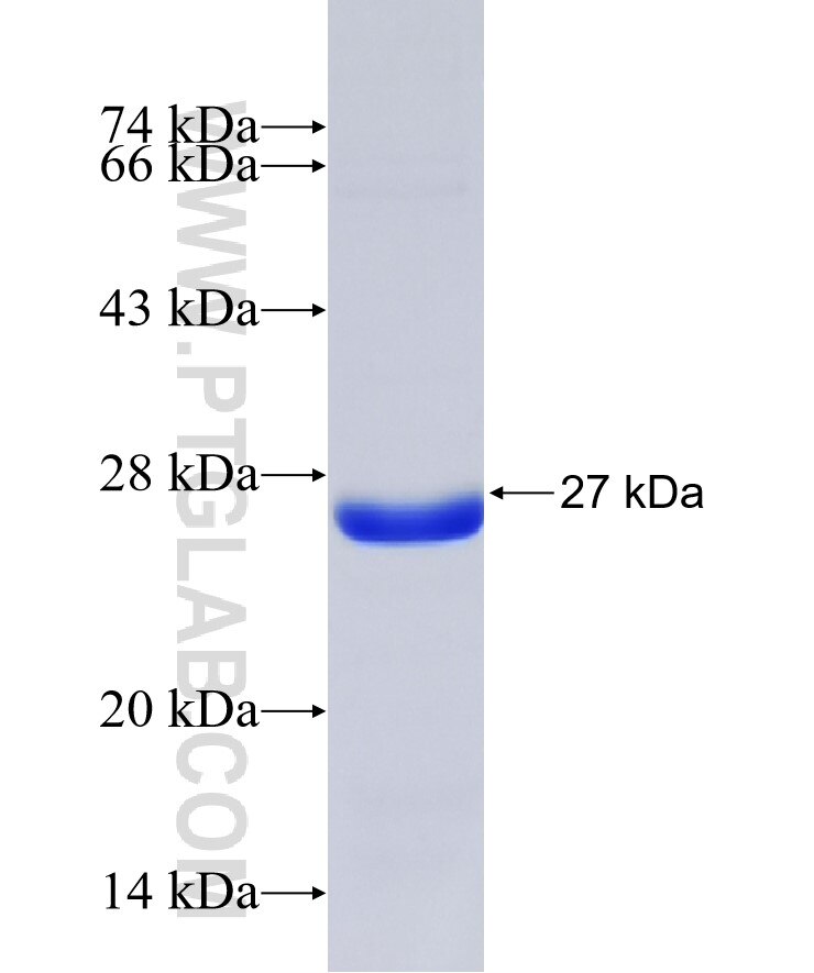 SERPINB1 fusion protein Ag35833 SDS-PAGE SERPINB1 fusion protein Ag35833 SDS-PAGE