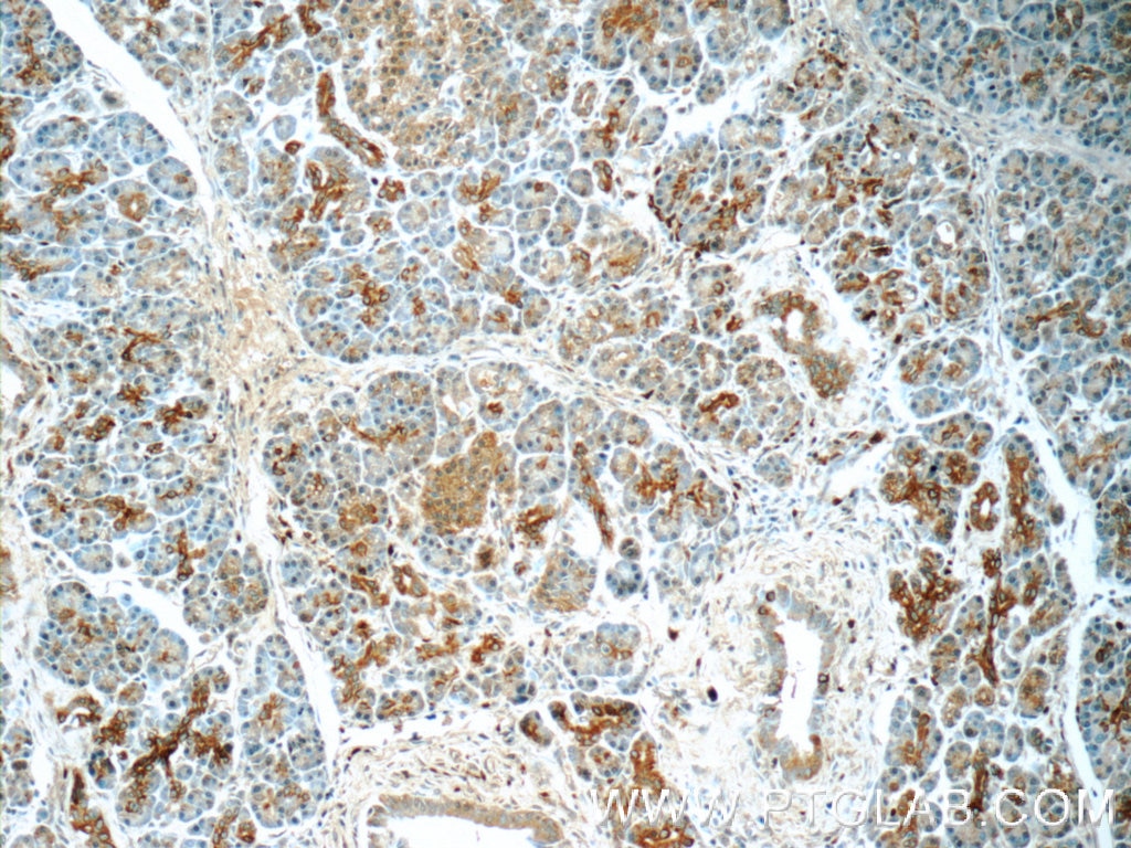 Immunohistochemistry (IHC) staining of human pancreas tissue using SERPINB10 Polyclonal antibody (21719-1-AP)