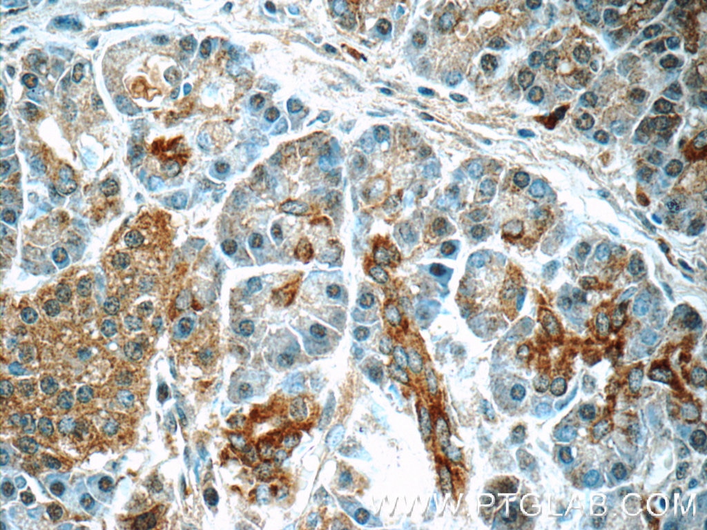 Immunohistochemistry (IHC) staining of human pancreas tissue using SERPINB10 Polyclonal antibody (21719-1-AP)