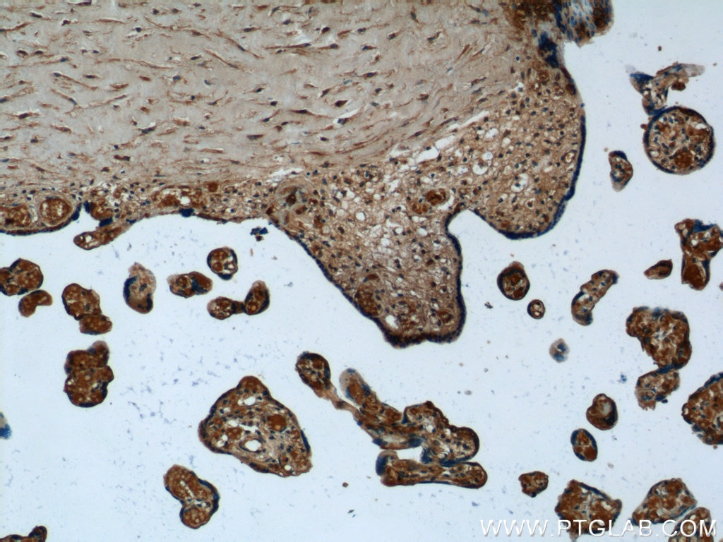 Immunohistochemistry (IHC) staining of human placenta tissue using SERPINB10 Polyclonal antibody (21719-1-AP)