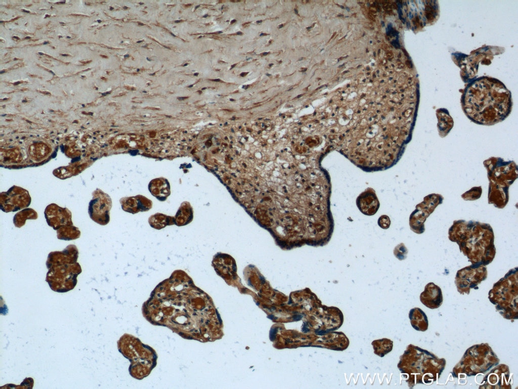 IHC staining of human placenta using 21719-1-AP