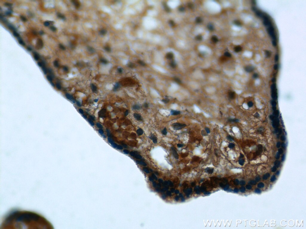 Immunohistochemistry (IHC) staining of human placenta tissue using SERPINB10 Polyclonal antibody (21719-1-AP)