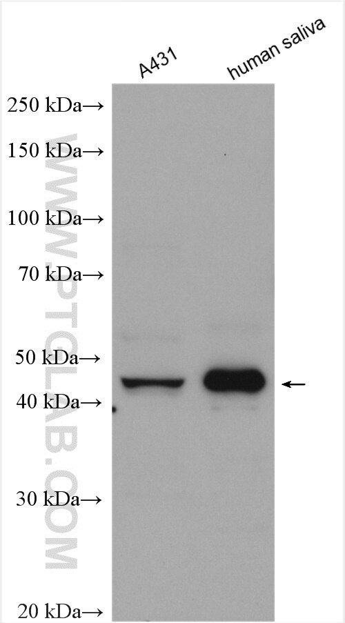 Western Blot (WB) analysis of various lysates using SERPINB10 Polyclonal antibody (21719-1-AP)