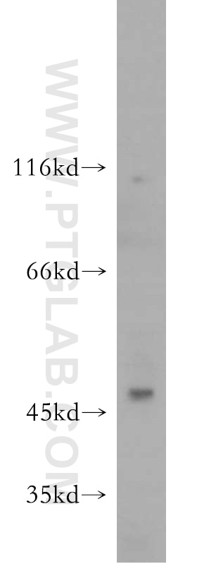 Western Blot (WB) analysis of HL-60 cells using SERPINB10 Polyclonal antibody (21719-1-AP)