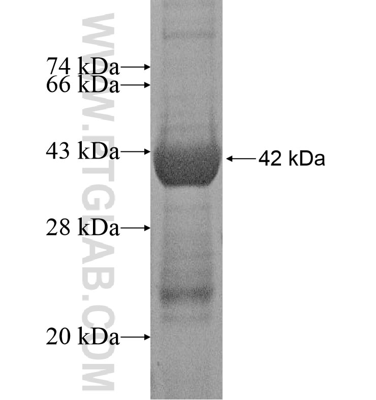 SERPINB11 fusion protein Ag16538 SDS-PAGE