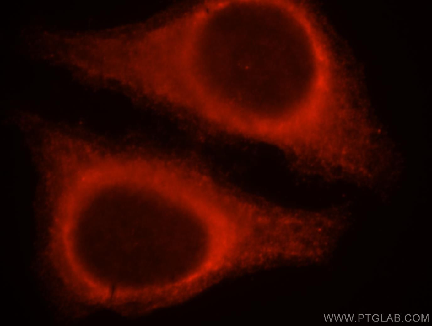 Immunofluorescence (IF) / fluorescent staining of HepG2 cells using SERPINB13 Polyclonal antibody (18045-1-AP)