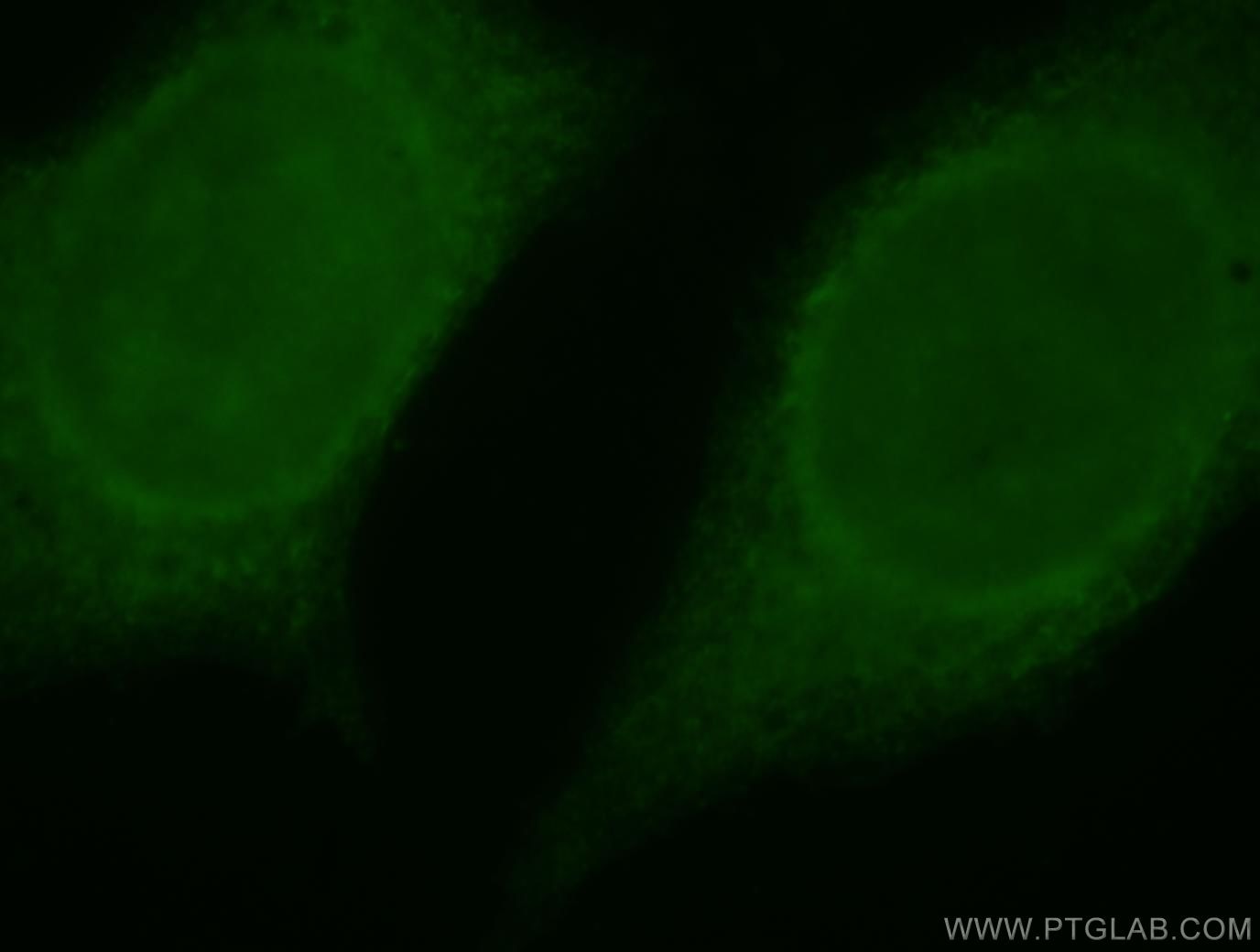 Immunofluorescence (IF) / fluorescent staining of HeLa cells using SERPINB13 Polyclonal antibody (18045-1-AP)