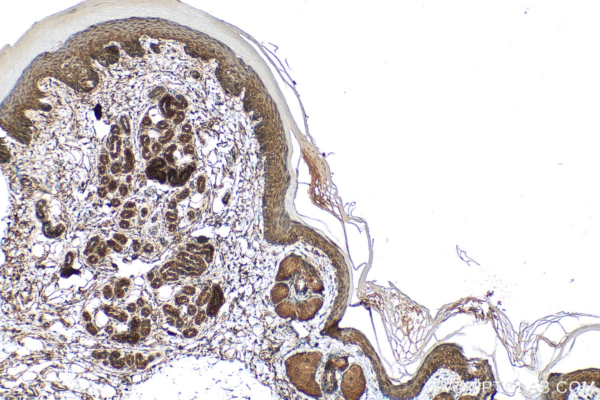 Immunohistochemistry (IHC) staining of mouse skin tissue using SERPINB13 Polyclonal antibody (18045-1-AP)