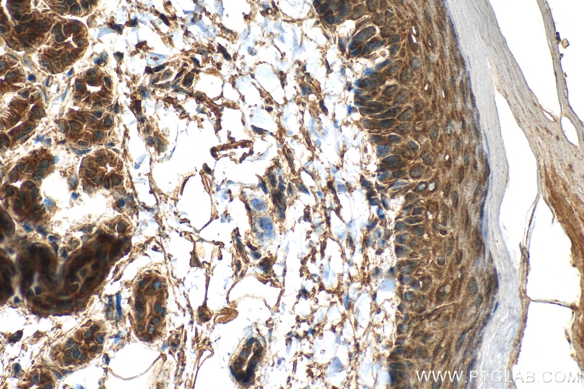 Immunohistochemistry (IHC) staining of mouse skin tissue using SERPINB13 Polyclonal antibody (18045-1-AP)