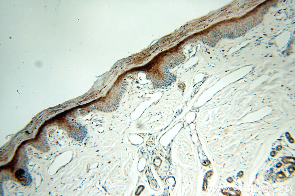 Immunohistochemistry (IHC) staining of human skin tissue using SERPINB13 Polyclonal antibody (18045-1-AP)