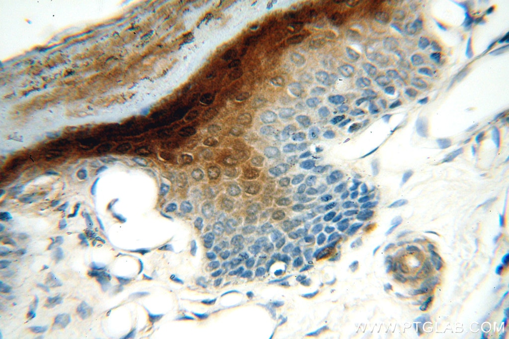 IHC staining of human skin using 18045-1-AP