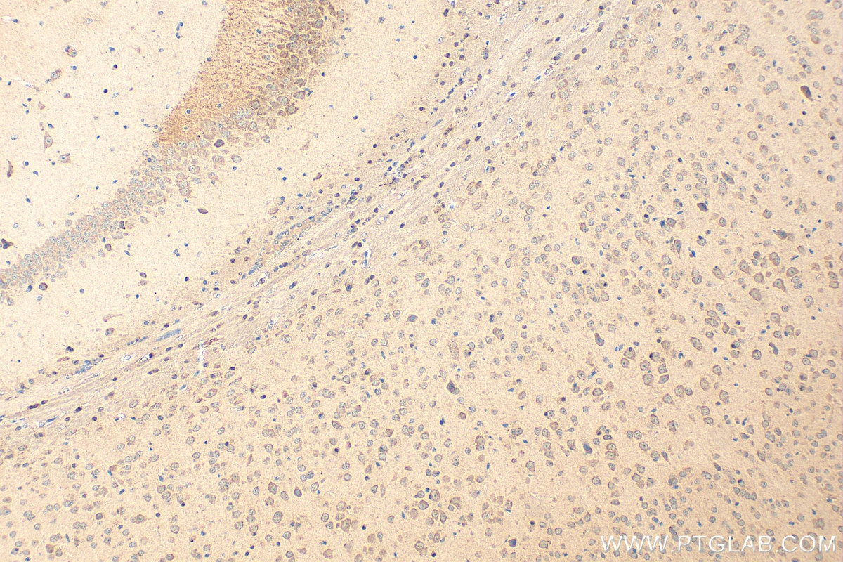 Immunohistochemistry (IHC) staining of mouse brain tissue using SERPINB2 Polyclonal antibody (16035-1-AP)